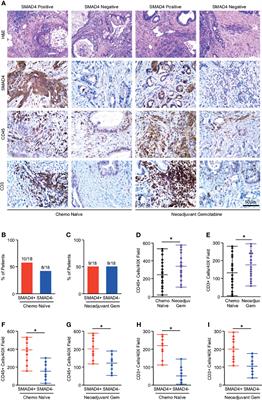 Loss of SMAD4 Is Associated With Poor Tumor Immunogenicity and Reduced PD-L1 Expression in Pancreatic Cancer